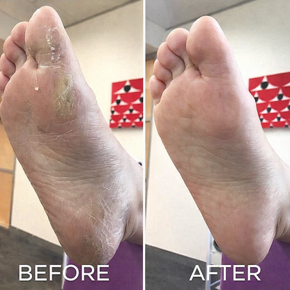 Electric Foot Grinder